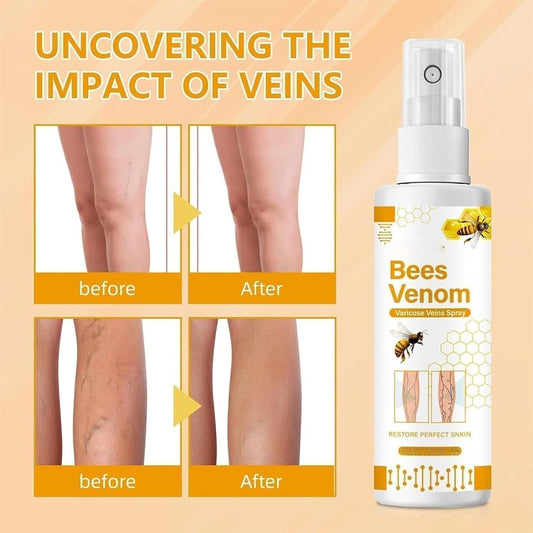 Bee Venom Spider Veins Spray (Pack of 2)